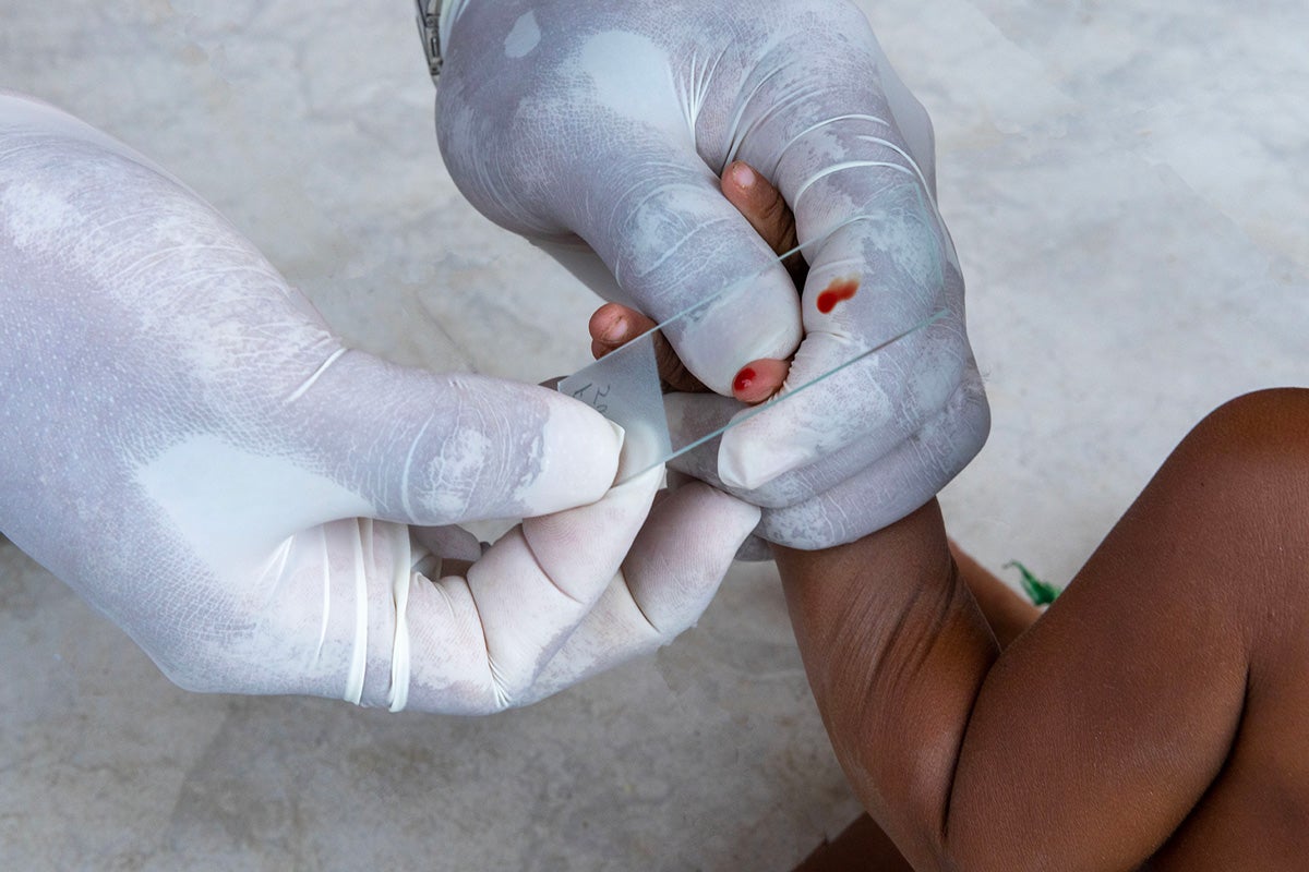 A health worker collects blood for the diagnosis of malaria in a Yanomami child, at Casai.