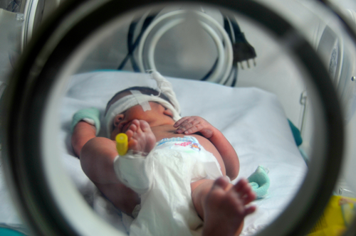 newborn in neonatal care