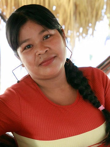 Paciente mirando a camara