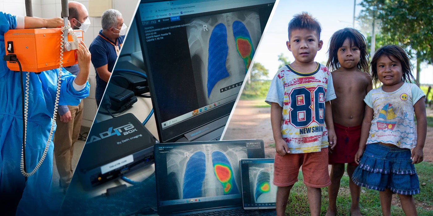 Images from TB diagnosis, children, etc.