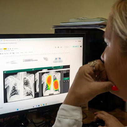 Regional Initiative to Accelerate Innovation for TB Elimination