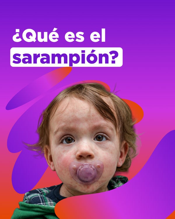 ¿Qué es el sarampión?