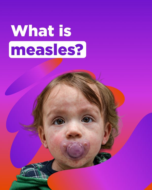 What is meales?