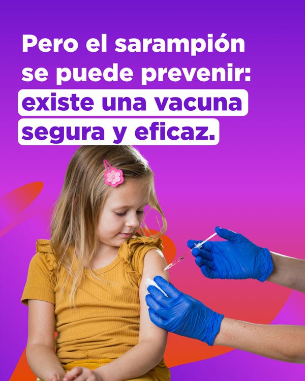 El sarampión se puede prevenir con vacunación