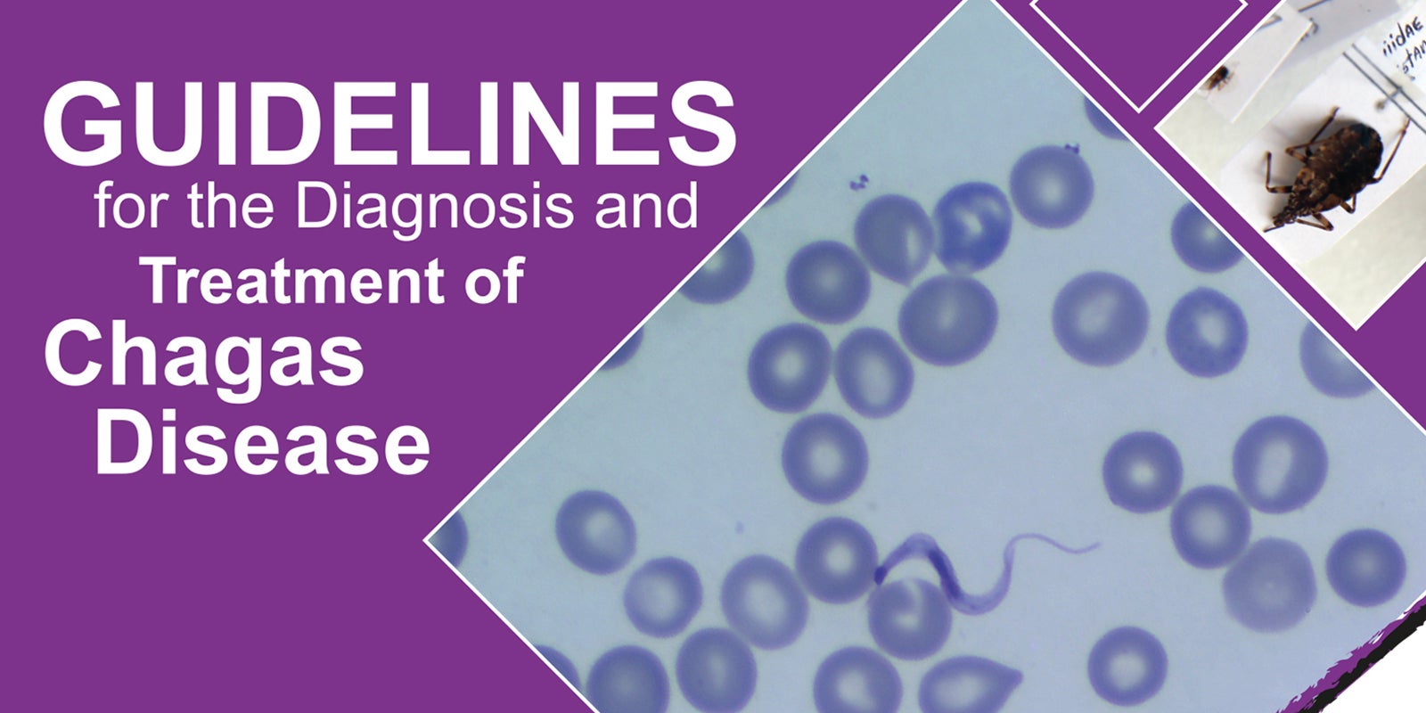 Chagas guidelines