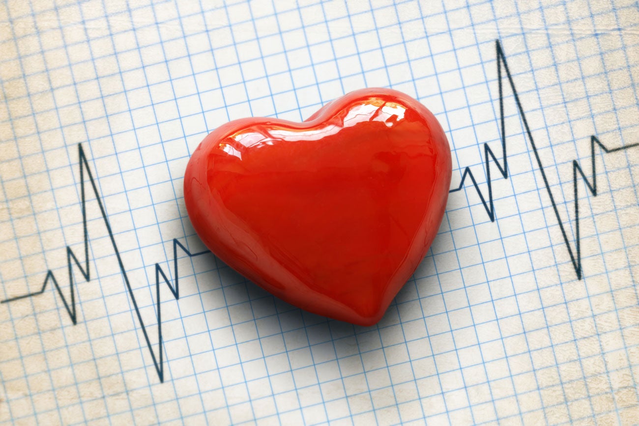 Cardiograma