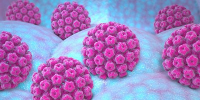 ¿Qué es y qué consecuencias trae el Virus del Papiloma Humano?