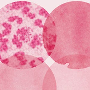 Antibiotic-resistant gonorrhoea on the rise, new drugs needed