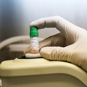 Zika in the Americas: A Storm in the Making