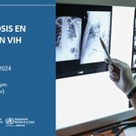 Webinario: Histoplasmosis en personas con VIH