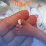 Pie de bebé prematuro en la mano de la madre