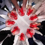 Webinarios: ECHO Educación continua en enfermedad avanzada por VIH