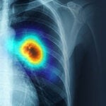 Primer foro para acelerar la eliminación de la TB en la región Andina