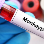 monkeypox test