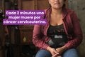 cancer cuello uterino