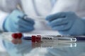 Prueba de ebola