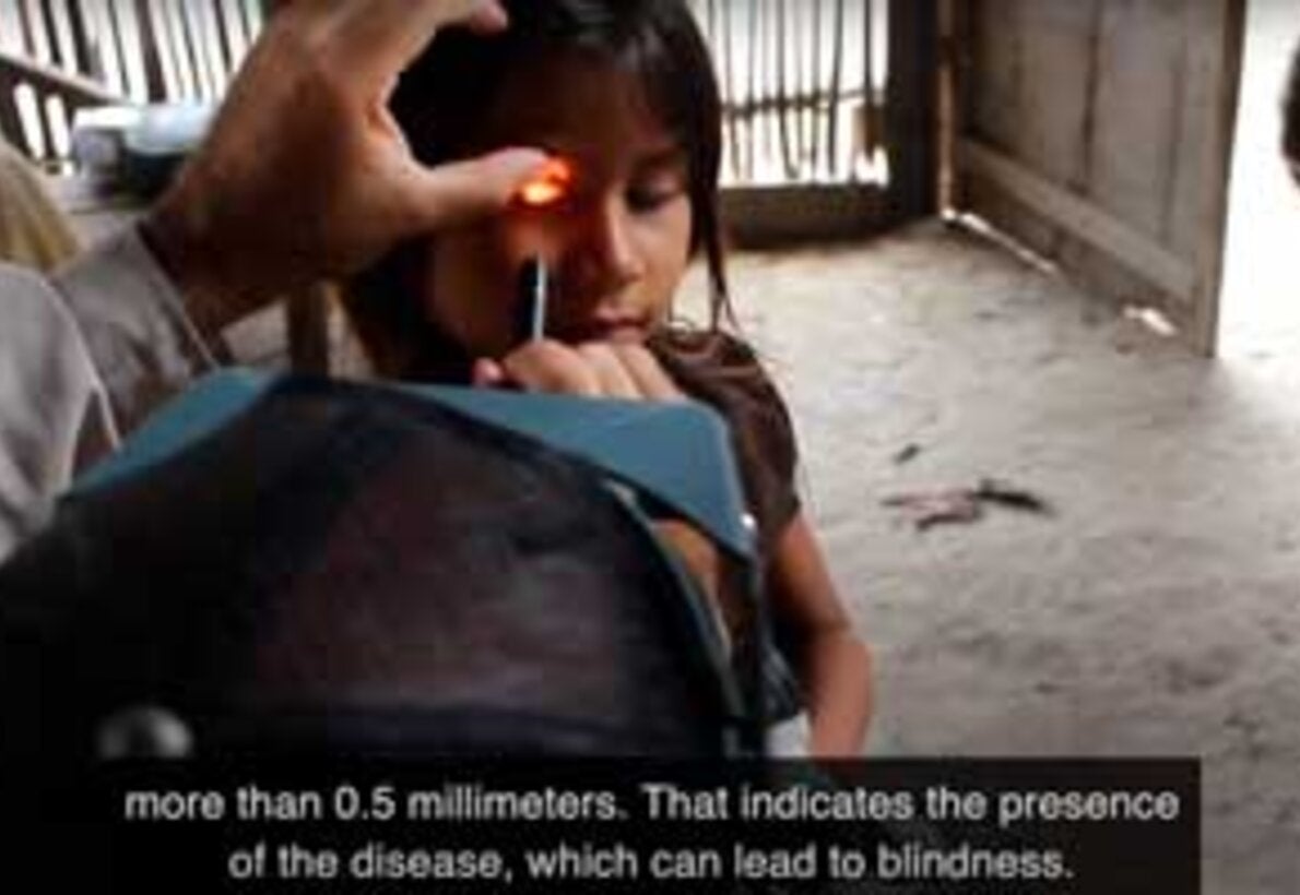 Búsqueda de tracoma en Venezuela