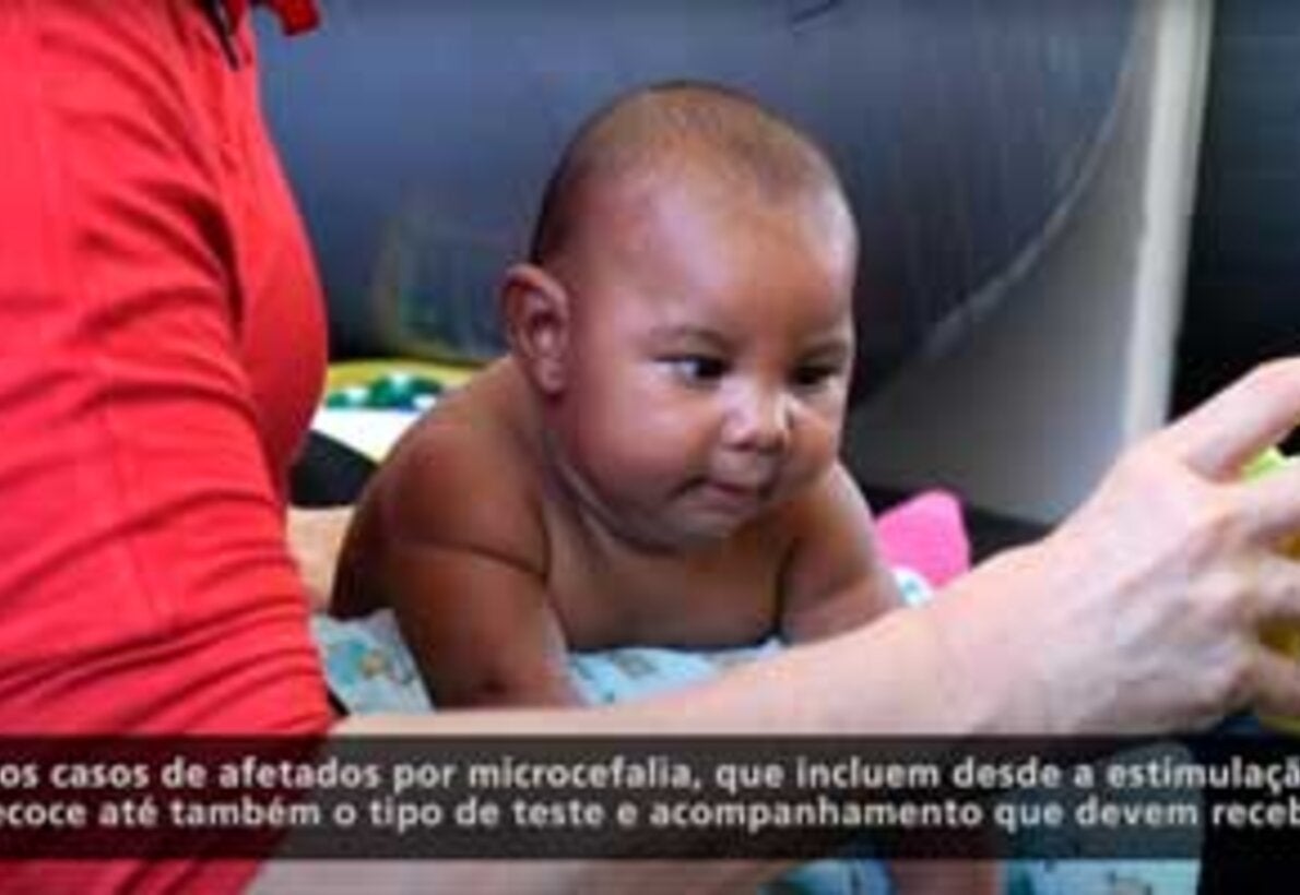 Estudo Caso Controle: zika e microcefalia em Recife