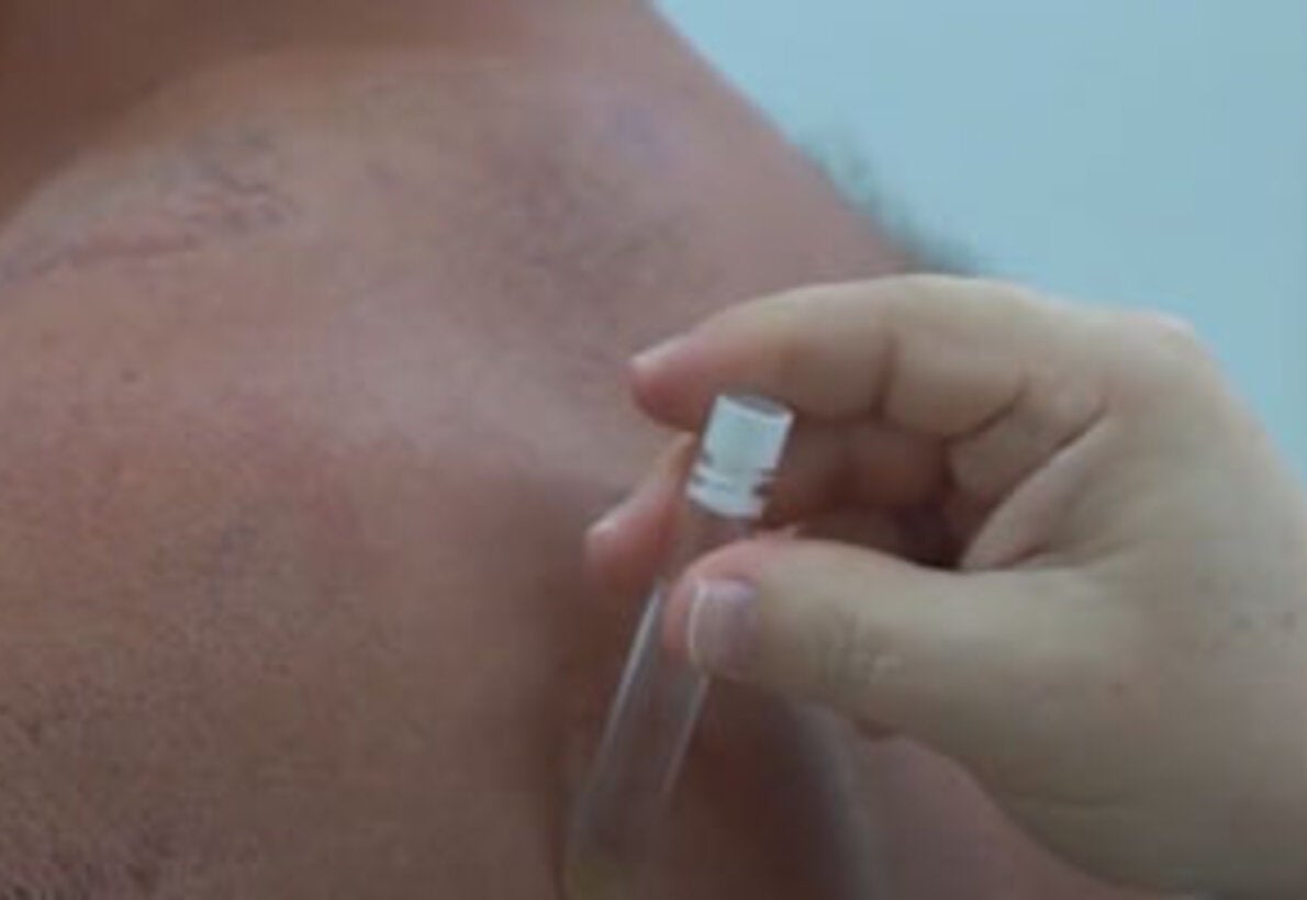 Clinic Evaluation of a Patient with Leprosy (In Spanish)