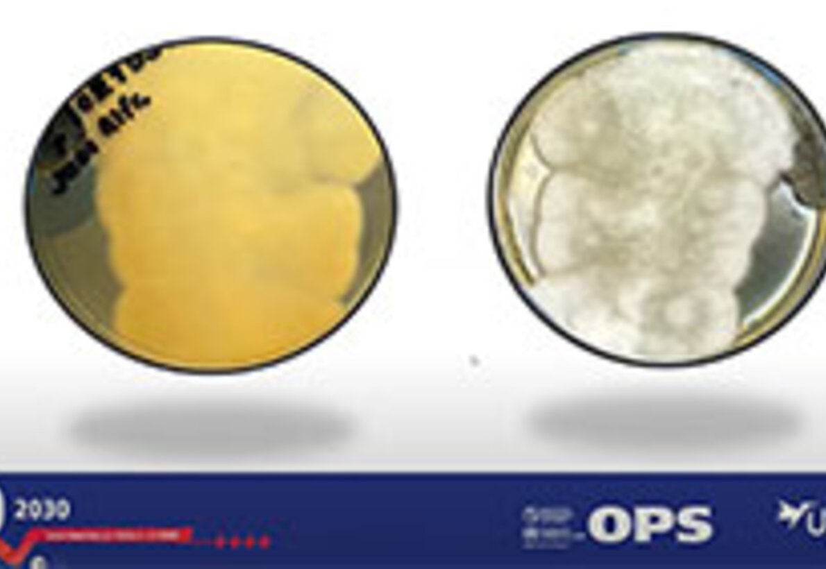 ECHO Educación Continua en Enfermedad Avanzada por VIH - 11 julio 2025