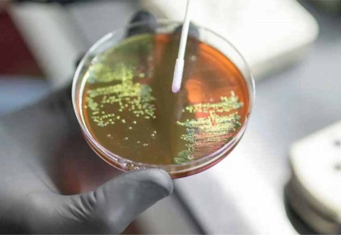Petri dish in lab