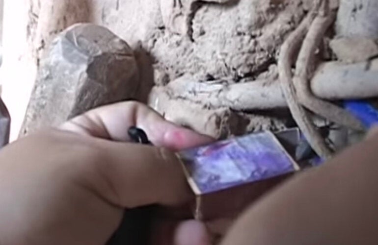 Chagas disease is a parasitic, systemic, and chronic disease caused by the protozoan Trypanosoma cruzi