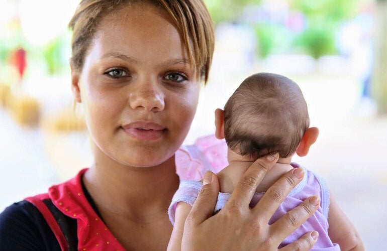 mother holding baby with microcephaly