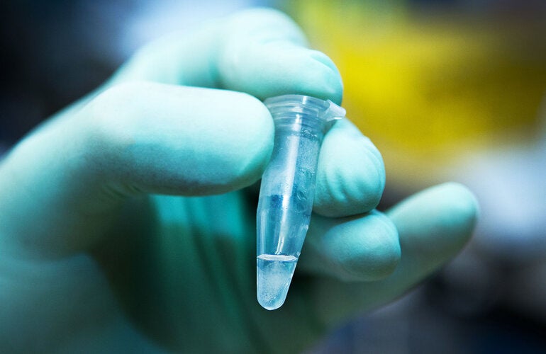 Researcher with green gloves holds laboratory vile