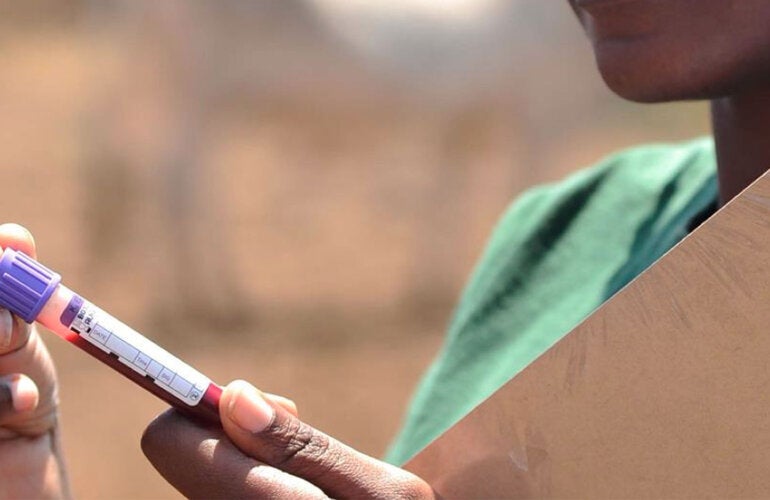 Muestra de sangre para test de ferritina