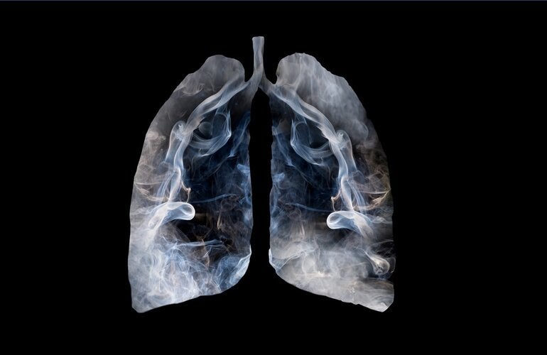 Pulmón con humo