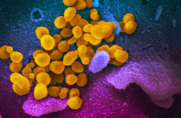  Imagen microscópica de COVID-19