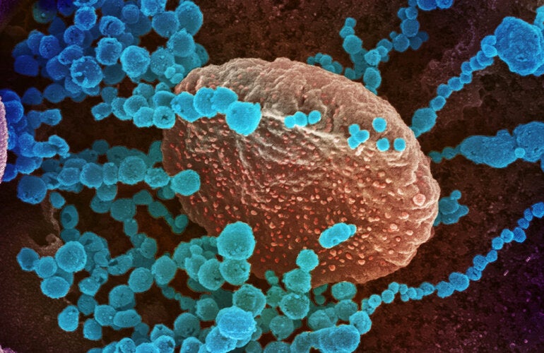 Electron microscope image of COVID-19