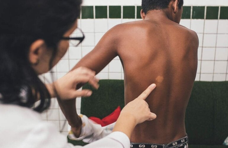  Médico examina paciente com hanseníase