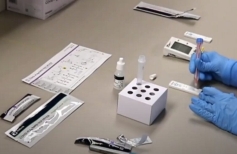 Prueba antígenos COVID-19