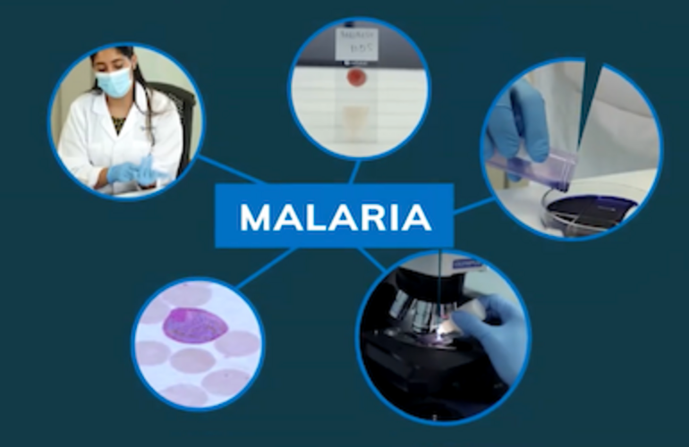 CursoVirtual_Malaria