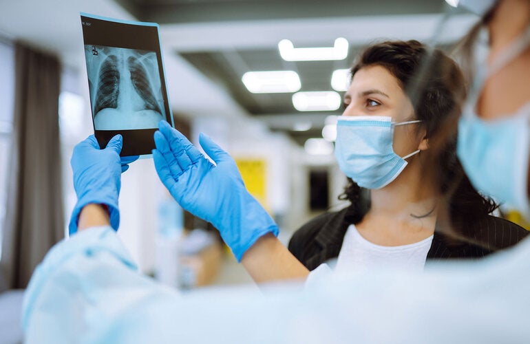 Radiografía de pulmones