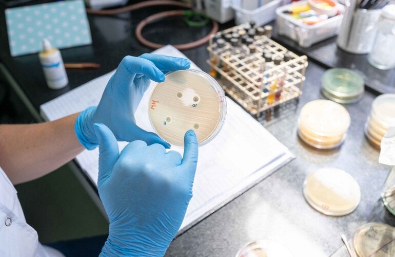 La imagen muestra la detección de mecanismos de resistencia utilizando un método manual.