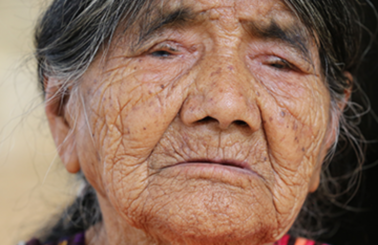 How Mexico eliminated trachoma, the leading preventable cause of blindness