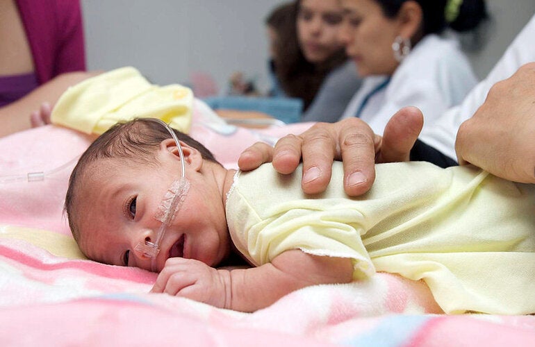 bebe prematuro, acostado boca abajo siendo revisado por personal de salud