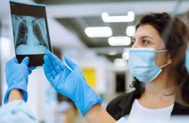woman looking at an x-ray of lungs