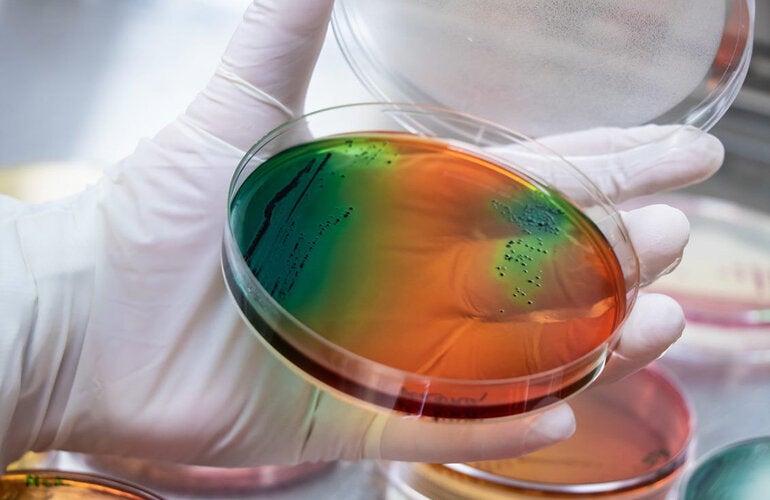 colorful image of a petri dish