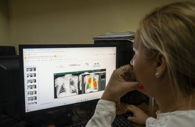 Profissional de saúde avaliando radiografias de pulmão no computador