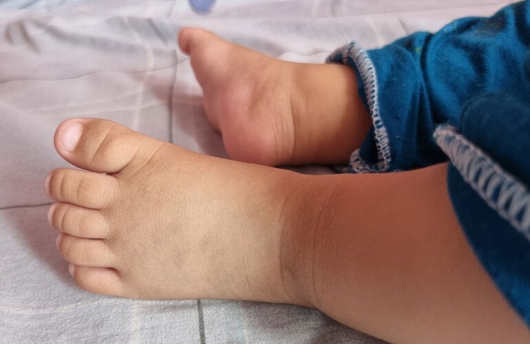 Babies feet