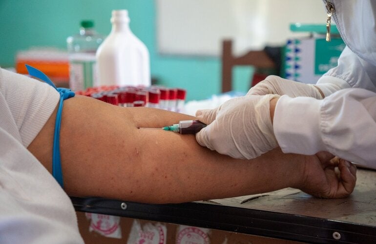 prueba hanta virus Bolivia