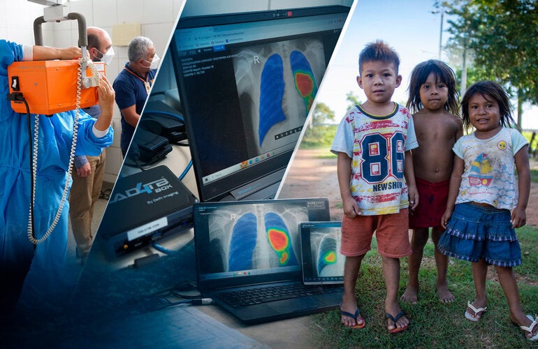 World Tuberculosis Day 2026