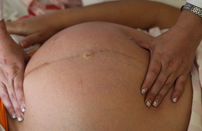 pregnant women receiving a physical examination