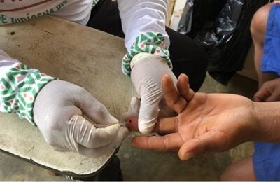 Malaria teste