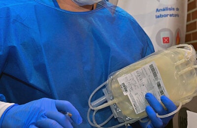 Bolsa de plasma con controles para asegurar calidad