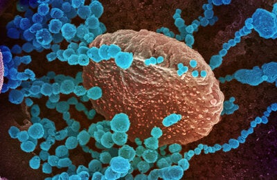 Electron microscope image of COVID-19