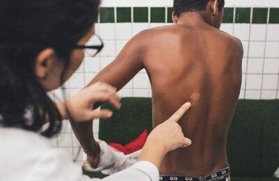 Doctor examines patient with leprosy